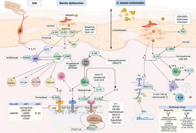 Atopic Dermatitis: New Targets and Emerging Systemic Therapies