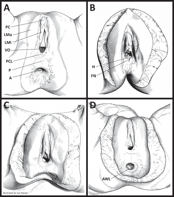 Forensic pathologic investigation of the female genital organs by complete pelvic exenteration: a step-by-step autopsy approach