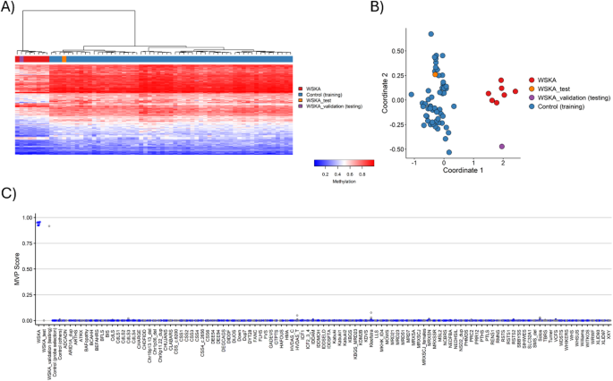 Discovery of a DNA methylation episignature for Weiss-Kruszka syndrome