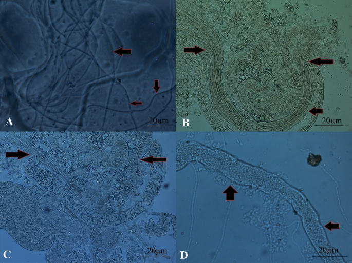 Cis-regulatory divergence and misexpression of spermatogenesis genes underlie hybrid male sterility in the  species complex
