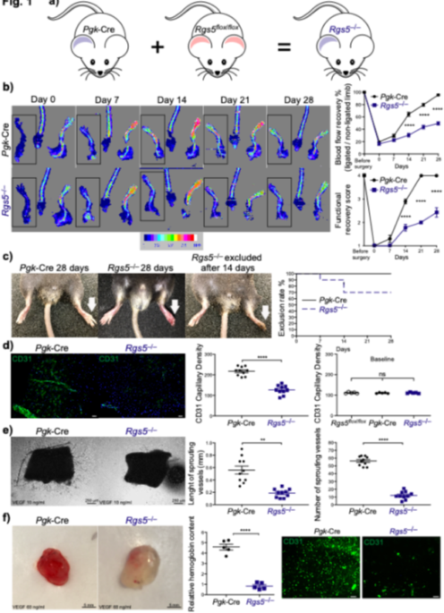 Critical role of endothelial regulator of G protein signaling 5 in postnatal angiogenesis