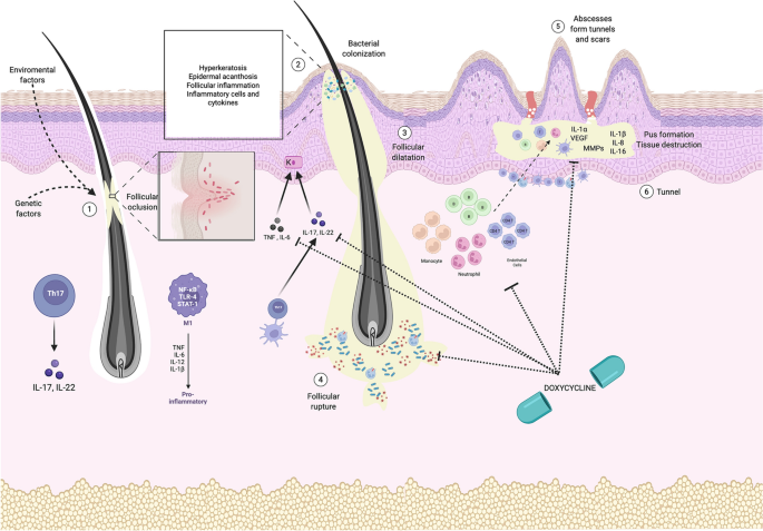 Effectiveness and Safety of 40 mg Modified-Release Doxycycline for the Treatment of Hidradenitis Suppurativa: A Single-Center Retrospective Observational Study