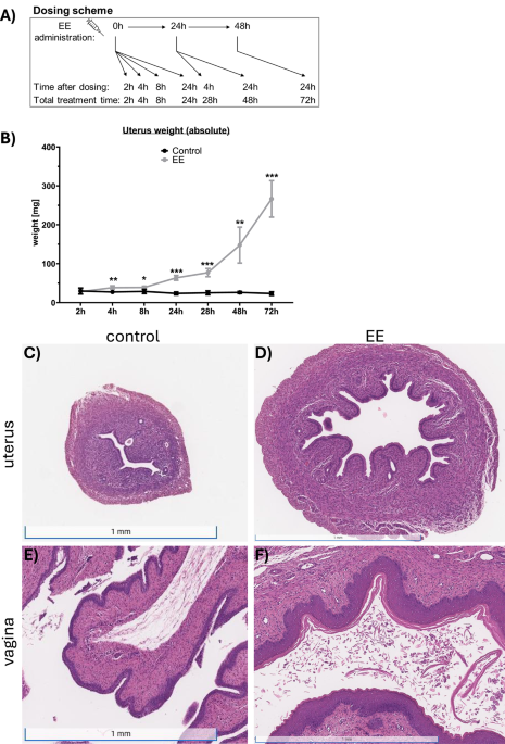 Molecular characterization of the uterotrophic assay: temporal gene expression changes in uterus and pituitary gland following ethinylestradiol