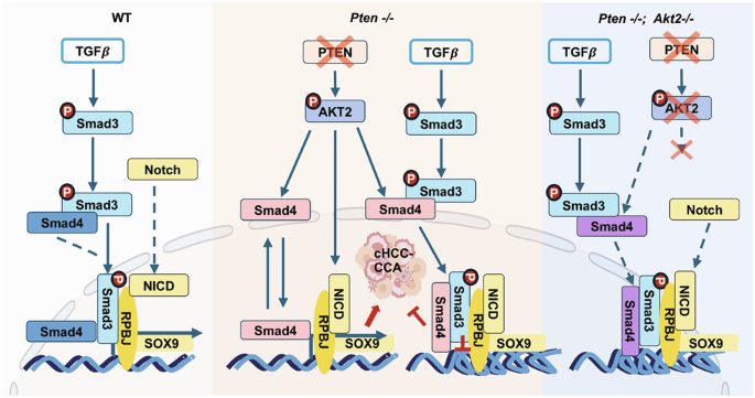 PTEN-AKT2 regulates mixed lineage liver cancer development and sensitizes cancer cells to TGFβ treatment