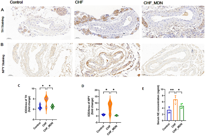 Mesenteric denervation ameliorates post‑infarction heart failure alongside alterations in the gut–nerve–microbiota axis