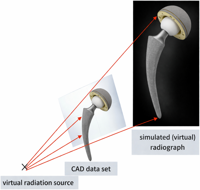 Long-term results of a vitamin E–blended polyethylene liner in total hip arthroplasty: a minimum ten year computer aided design based evaluation of wear and component positioning