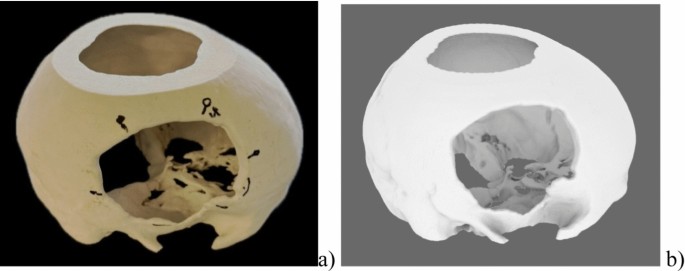 A real-time metric for quantifying registration stability in mixed reality neurosurgical navigation