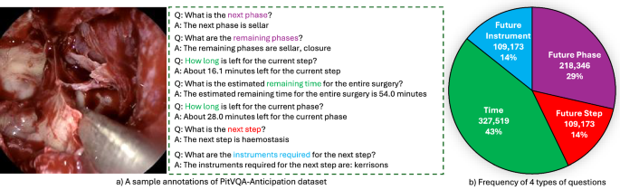SurgAnt-ViVQA: learning to anticipate surgical events through GRU-driven temporal cross-attention