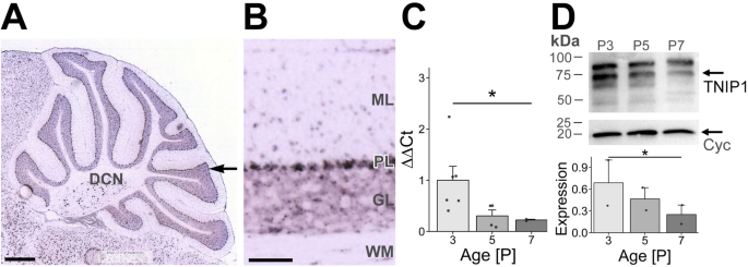 TNIP1 As A Potential Factor In Neuronal Survival, Growth and Differentiation in the Cerebellar Cortex