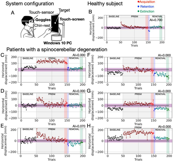Multicenter Validation of Cerebellar Motor Learning Biomarker for Spinocerebellar Degenerations