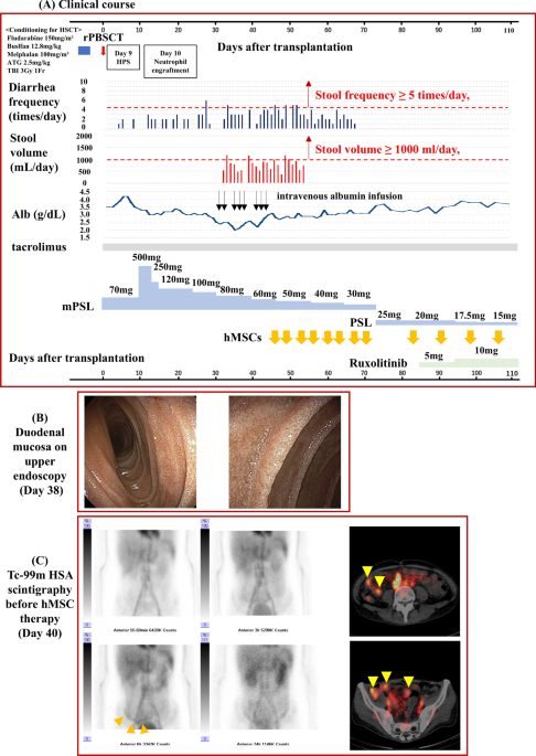 99mTc-HSA scintigraphy identifies protein-losing enteropathy in atypical GI-GVHD with modest diarrhea after allo-HSCT