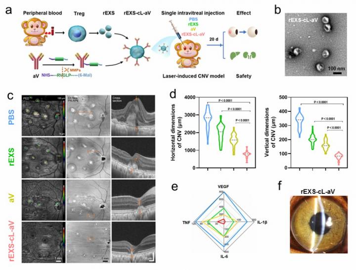 Exosome formulation developed to deliver antibodies for choroidal neovascularization therapy