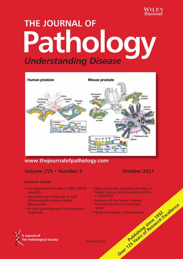 The utility of color normalization for AI‐based diagnosis of hematoxylin and eosin‐stained pathology images