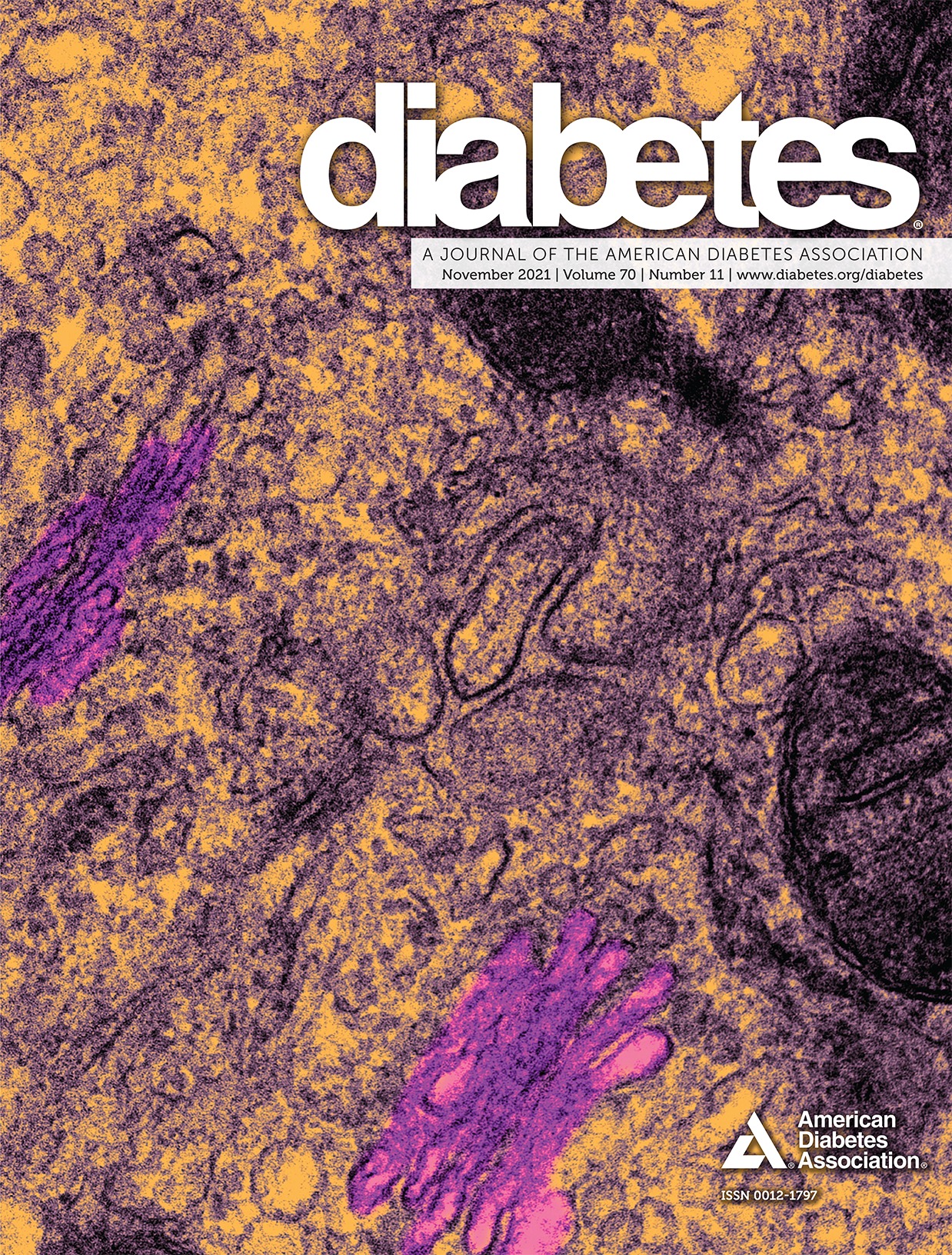Hepatocytic Activating Transcription Factor 3 Protects Against Steatohepatitis via Hepatocyte Nuclear Factor 4{alpha}