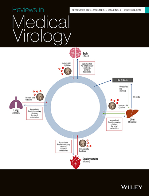 Role of ORF8a as accessory protein in apoptosis induction in SARS‐CoV‐2 infection