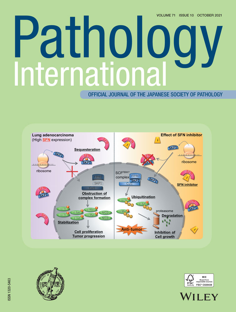 Lipoleiomyoma arising in soft tissue of the middle mediastinum