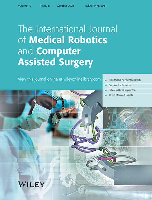 A comparison of robotic versus laparoscopic distal pancreatectomy: Propensity score matching analysis