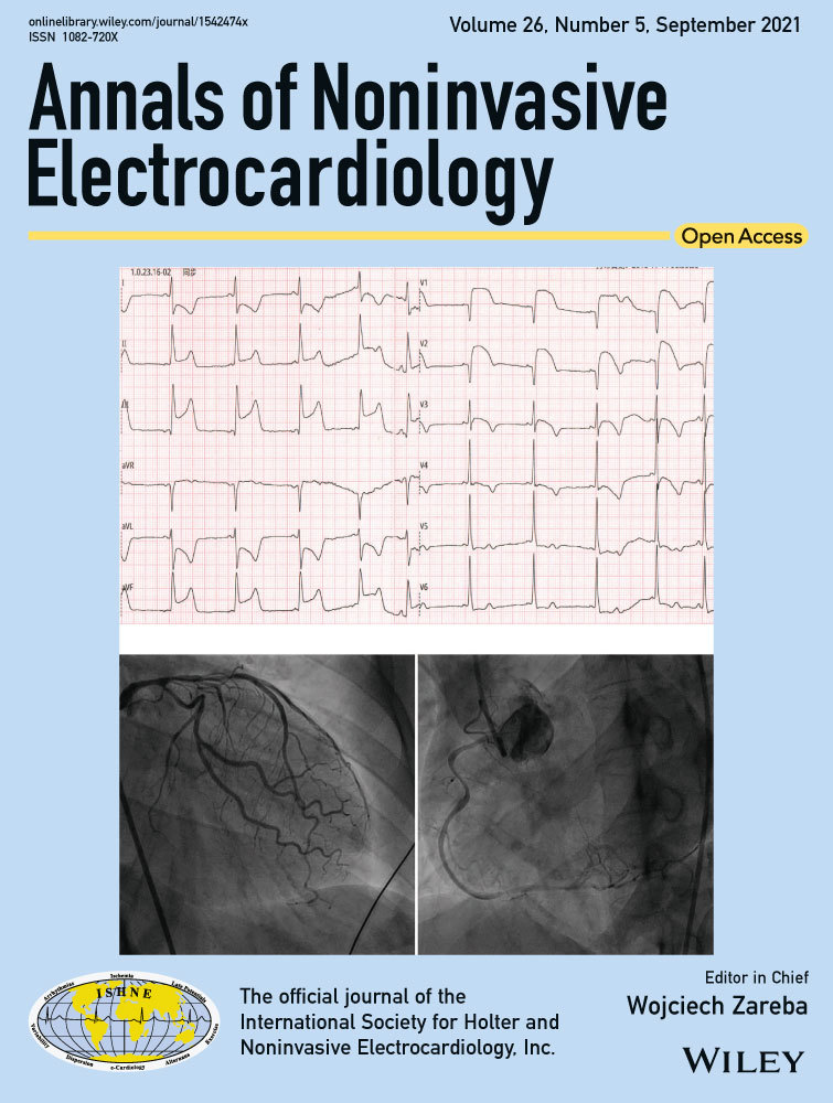 Successful implantation of leadless pacemaker in a patient with giant right atrium and tricuspid valve stenosis