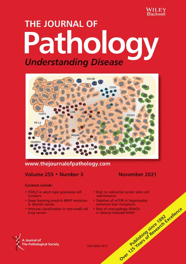 Clinical implications of cell‐of‐origin epigenetic characteristics in non‐functional pancreatic neuroendocrine tumors
