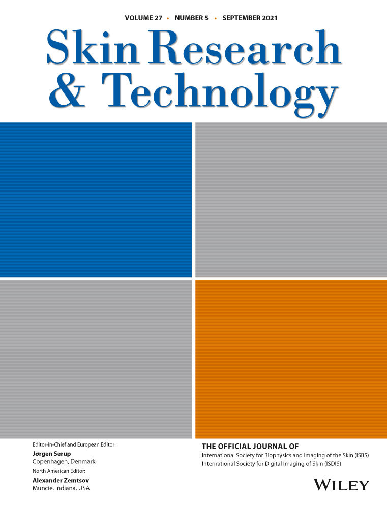 Automatic segmentation and melanoma detection based on color and texture features in dermoscopic images