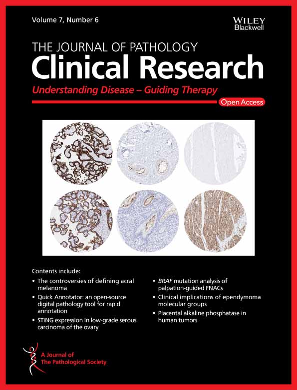 Expression of proteins associated with the Warburg‐effect and survival in colorectal cancer