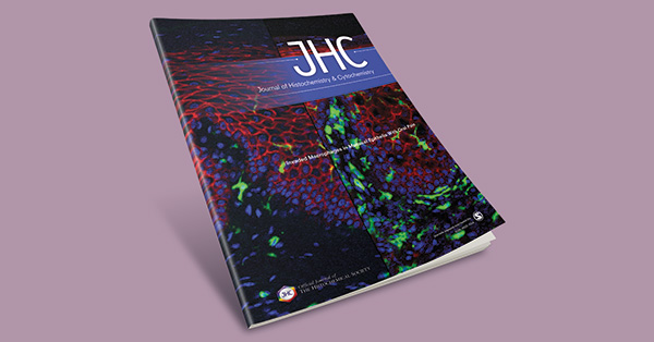 Defining a (Cancer Stem Cell) Niche