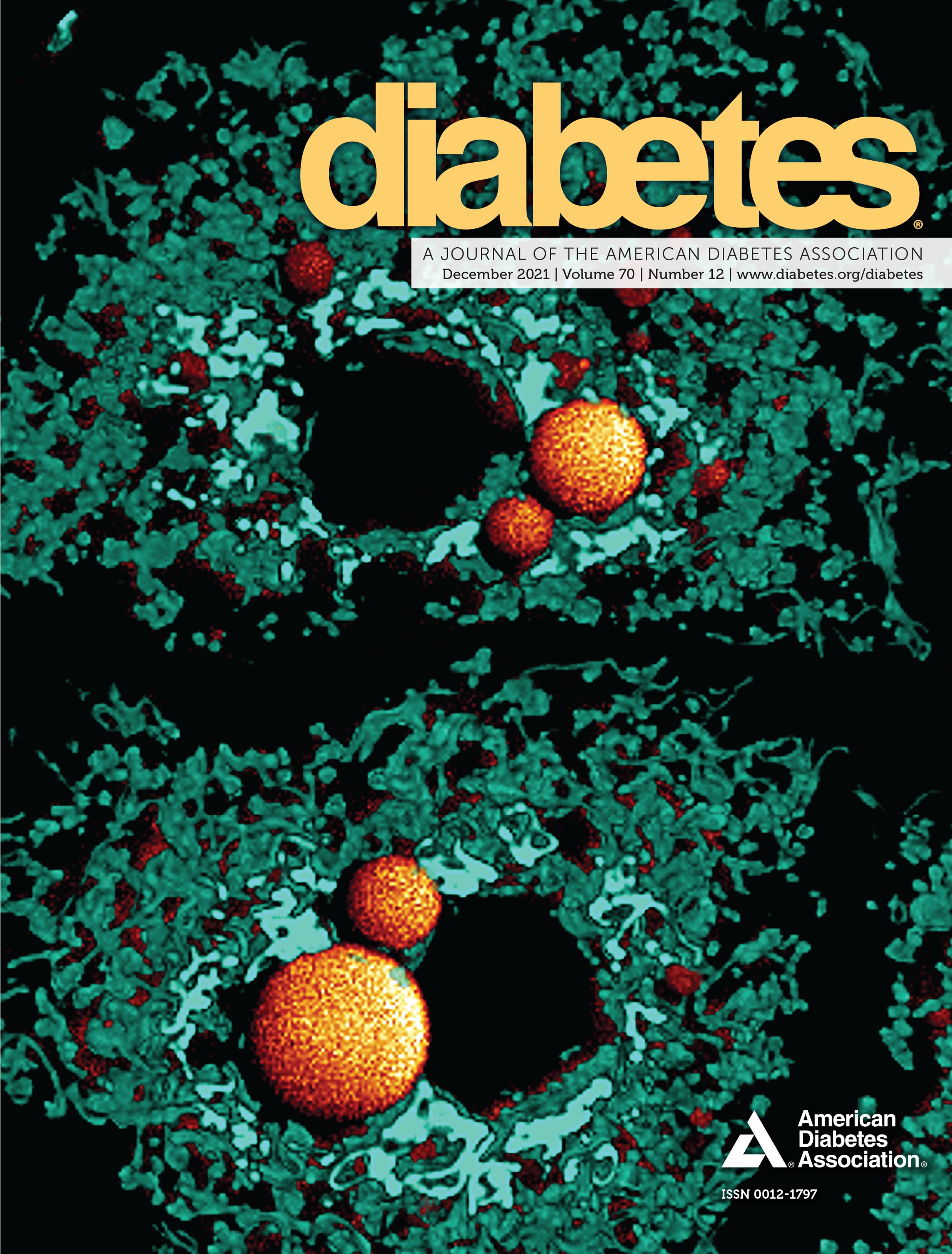 Developmental Timing of High-Fat Diet Exposure Impacts Glucose Homeostasis in Mice in a Sex-Specific Manner