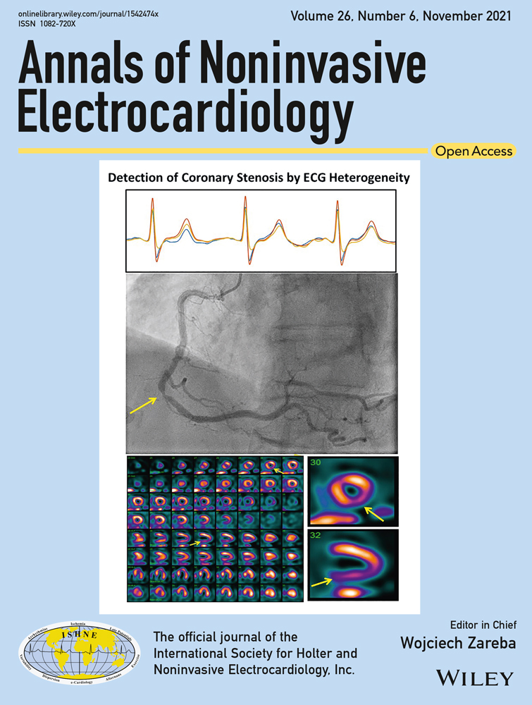 A potential diagnostic pitfall in ST elevation: Acute pulmonary embolism or ST‐segment elevation myocardial infarction
