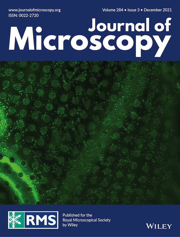 Automatic detection of kikuchi bands based on radon transform and PPHT