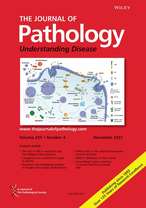 Activin B, a new player in kidney fibrosis?†