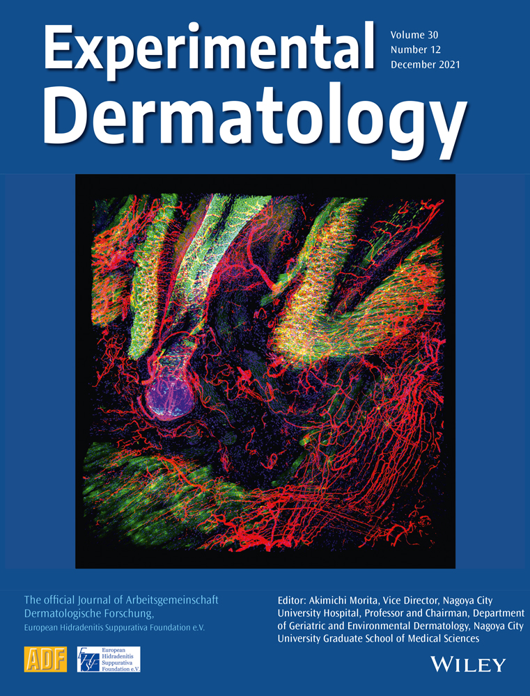 Transglutaminase 2 mediates UVB‐induced matrix metalloproteinase‐1 expression by inhibiting nuclear p65 degradation in dermal fibroblasts