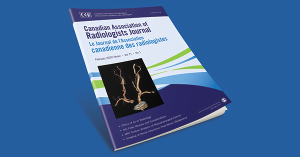The Canadian Society of Breast Imaging Recommendations for the Management of Axillary Adenopathy in Patients with Recent COVID-19 Vaccination - Update