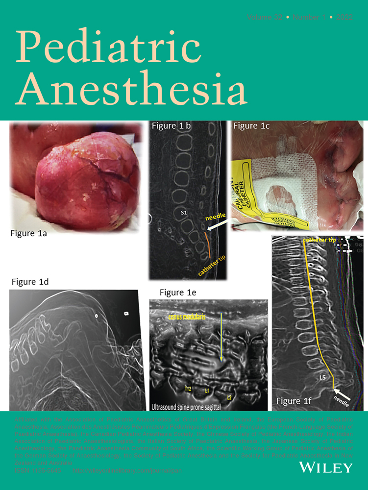 COVID‐19 Pandemic as Impetus for Sustained Utilization of Home Peripheral Nerve Catheter Program