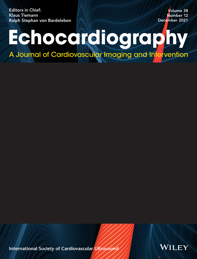 Native mitral valve staphylococcus endocarditis with a very unusual complication: Ruptured posterior mitral valve leaflet aneurysm
