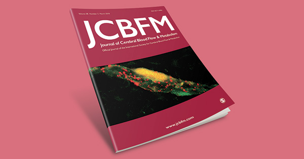 Distinct features of brain perivascular fibroblasts and mural cells revealed by in vivo two-photon imaging