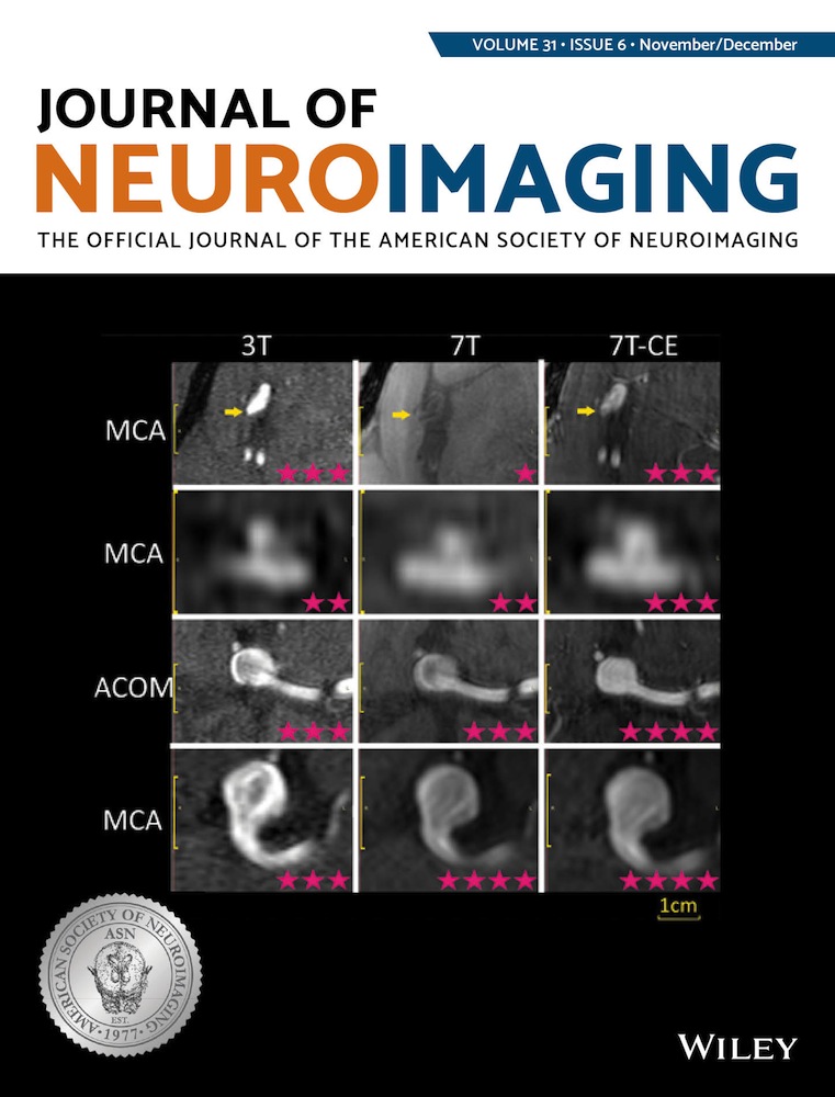 Cortico‐striatal functional connectivity and cerebral small vessel disease: Contribution to mild Parkinsonian signs