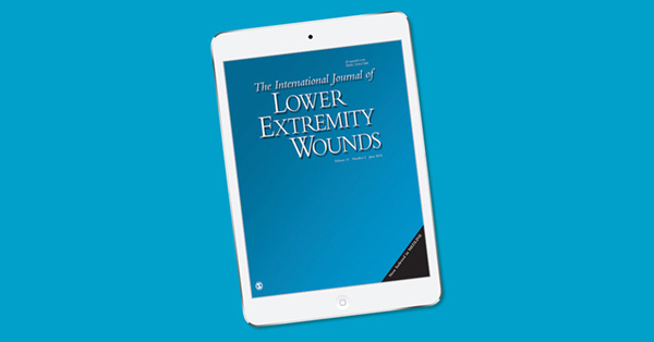 Limb Ischemia Associated With Covid-19 and Its Treatment With Above-Knee Amputation
