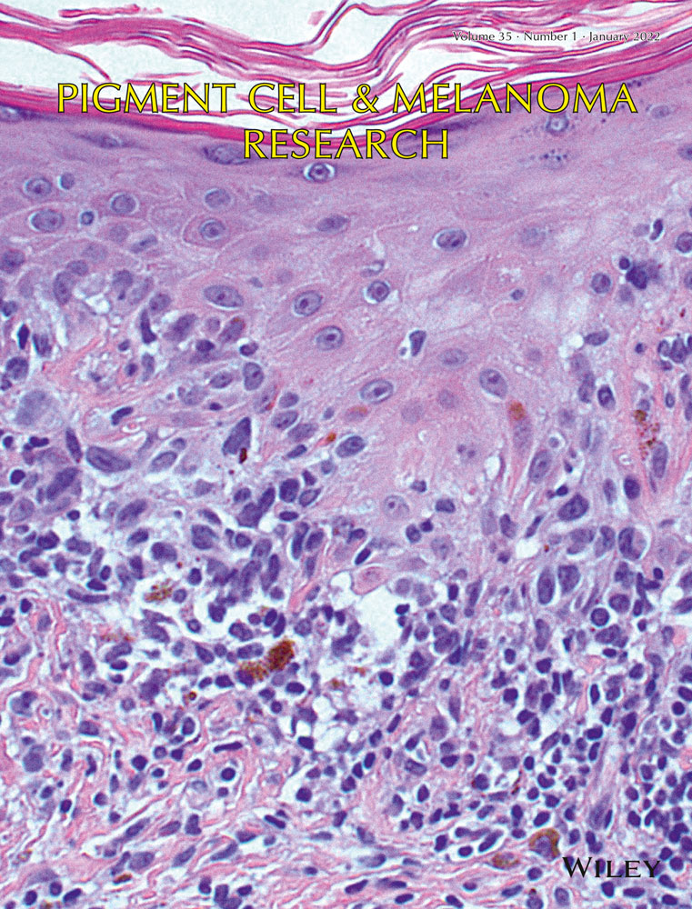 Prediagnostic serum 25‐hydroxyvitamin D and leptin in relation to melanoma‐specific and overall death