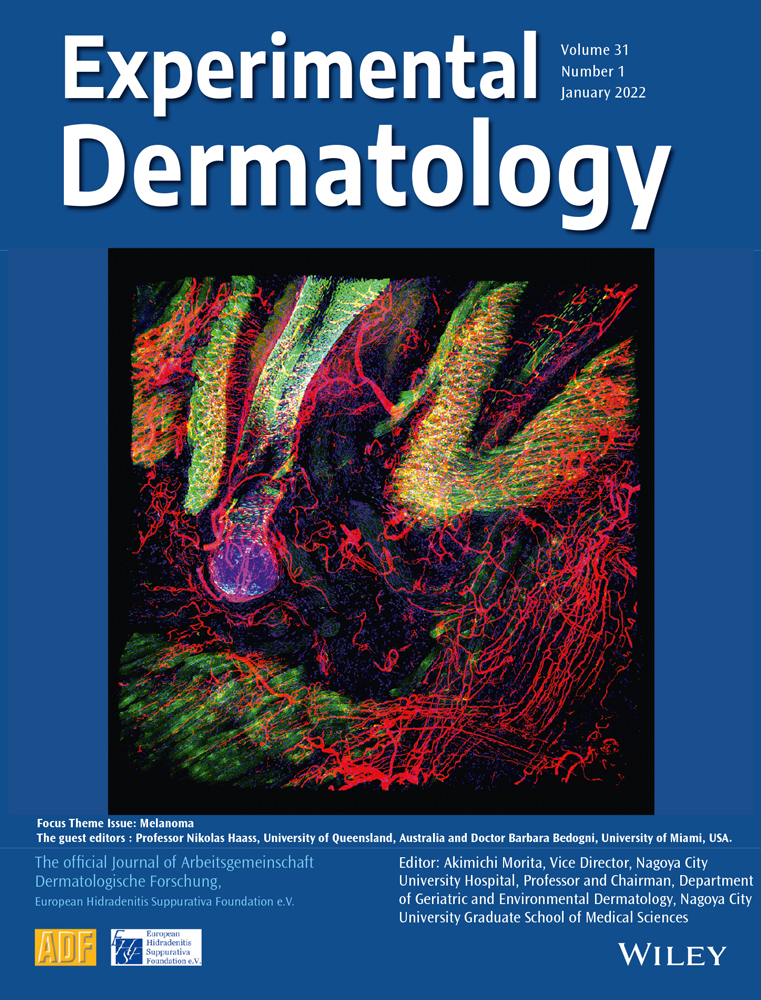 Long non‐coding RNA LINC00665 promotes melanoma cell growth and migration via regulating the miR‐224‐5p/VMA21 axis