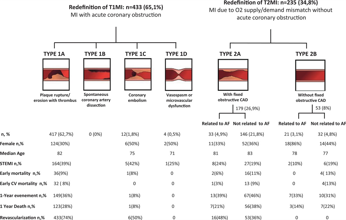 Preexisting atrial fibrillation and myocardial infarction: only 10% of infarcts directly linked to atrial fibrillation