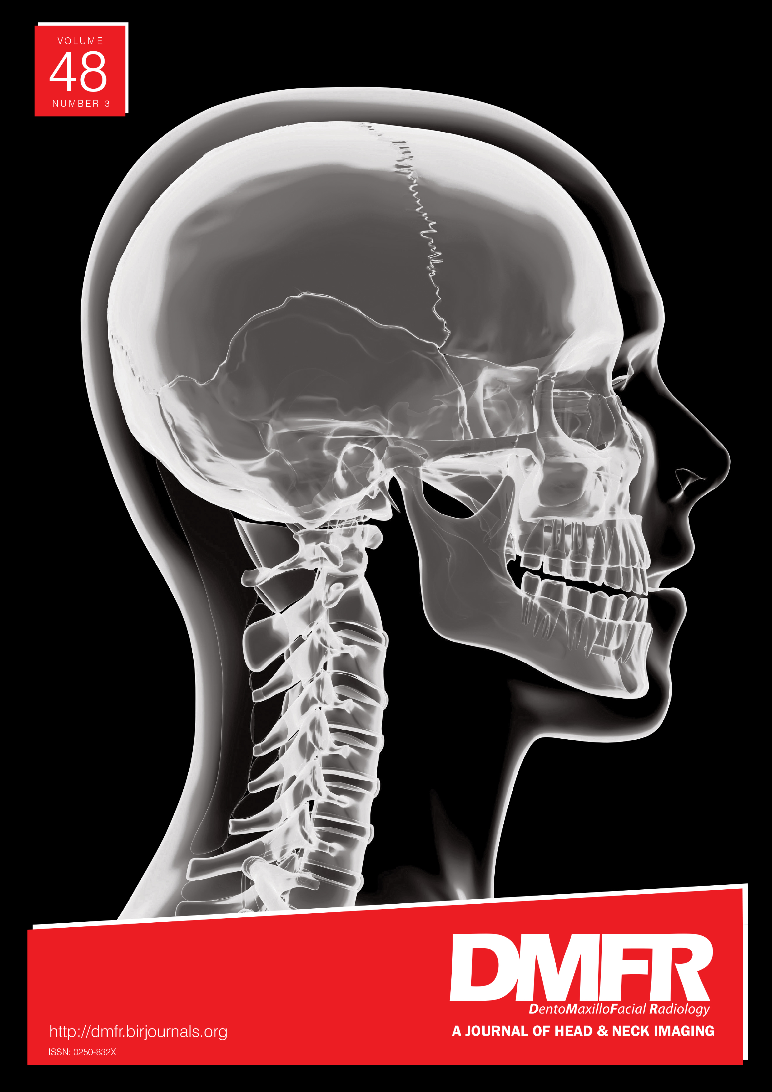 Comparison of subjective image analysis and effective dose between low-dose cone-beam computed tomography machines