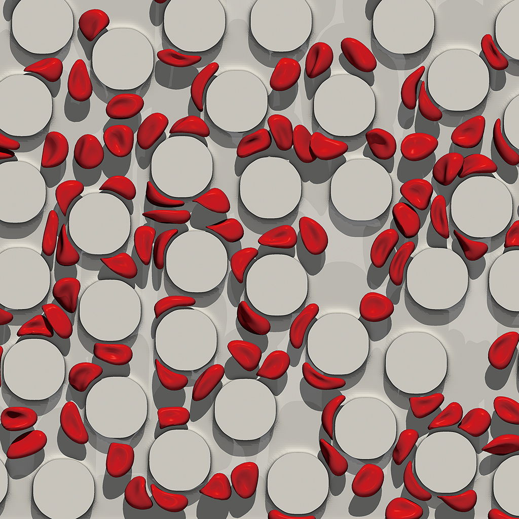 Semen rheology and its relation to male infertility