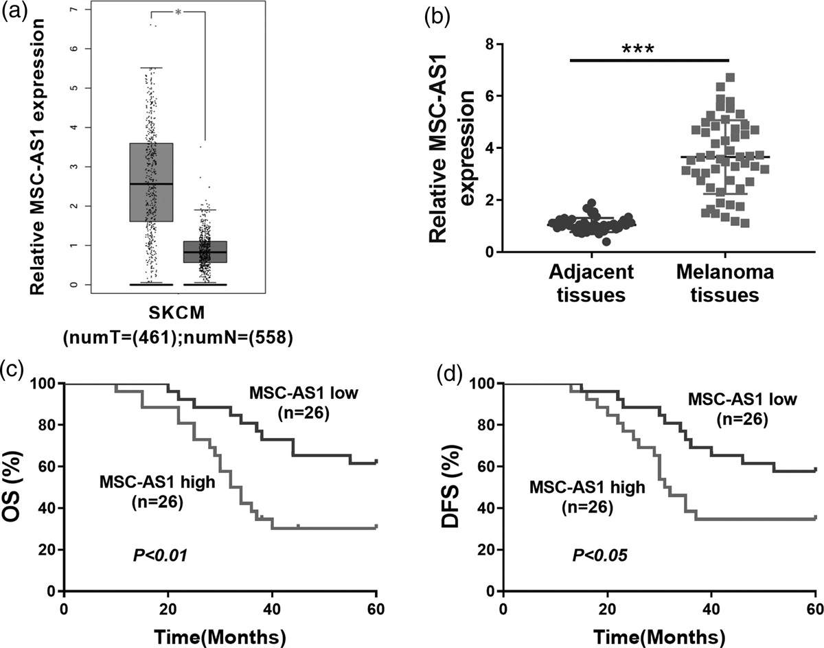 LncRNA MSC-AS1, as an oncogene in melanoma, promotes the proliferation and glutaminolysis by regulating the miR-330-3p/YAP1 axis