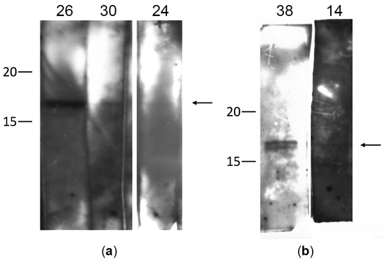 Biomedicines, Vol. 11, Pages 60: Gamma-Synuclein Dysfunction Causes Autoantibody Formation in Glaucoma Patients and Dysregulation of Intraocular Pressure in Mice