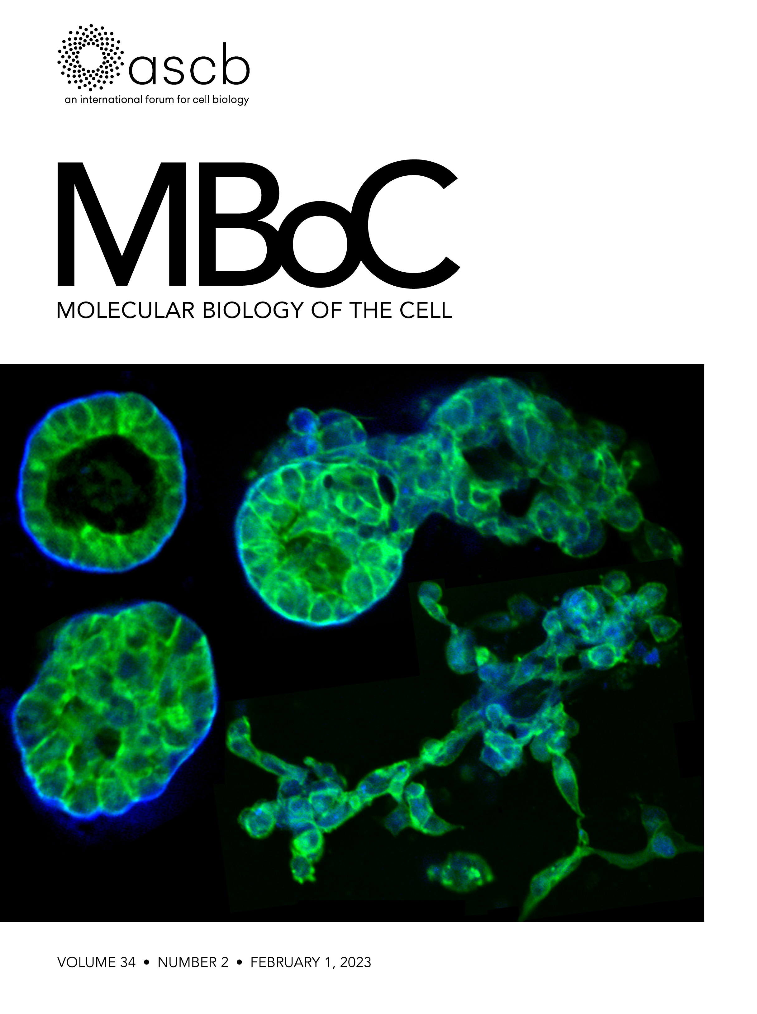 Preprint Highlight: LRRK2 Suppresses Lysosome Degradative Activity in Macrophages and Microglia via Transcription Factor E3 Inhibition