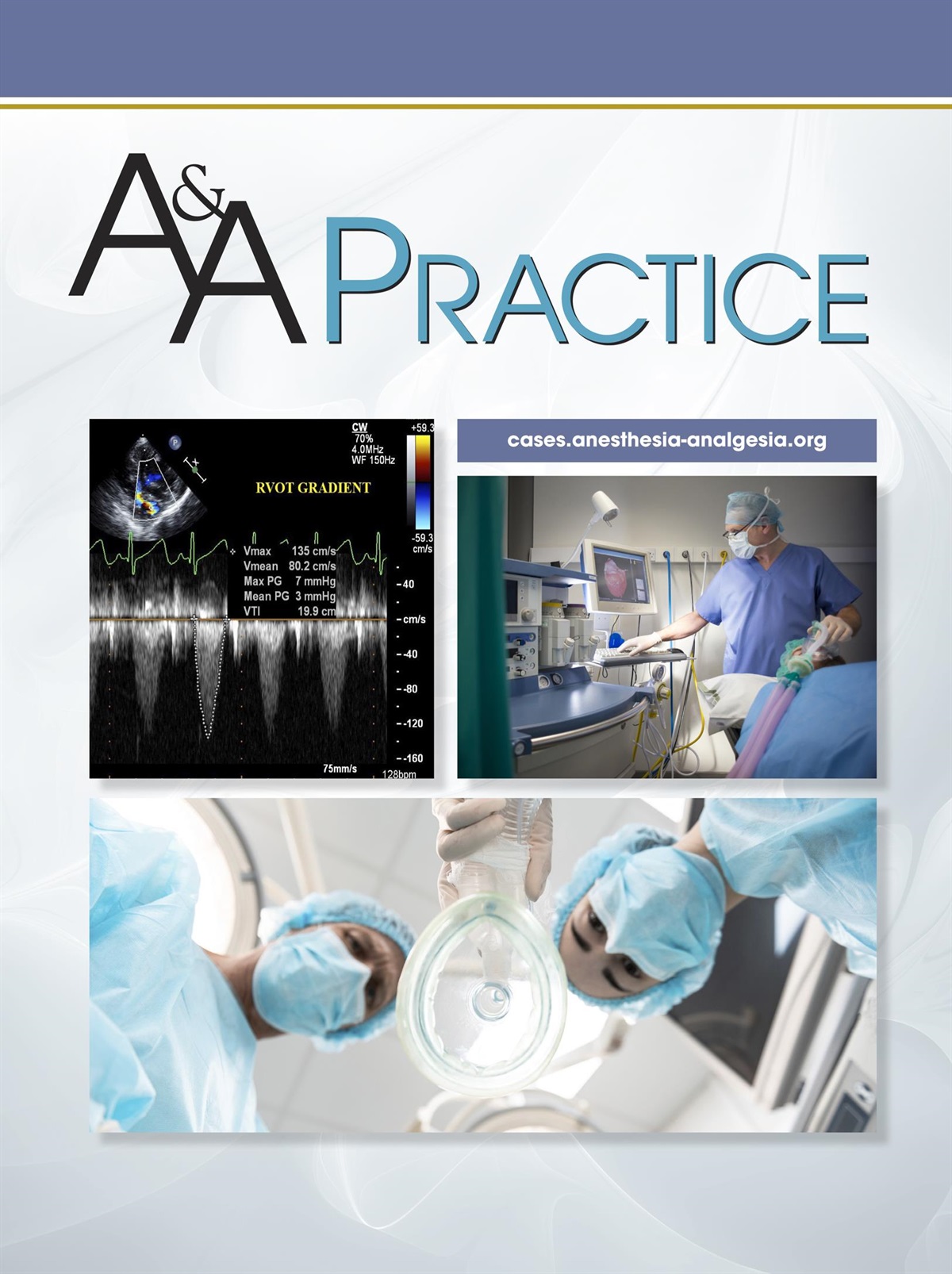 Anesthetic Considerations for an Adult With Bannayan-Riley-Ruvalcaba Syndrome: A Case Report