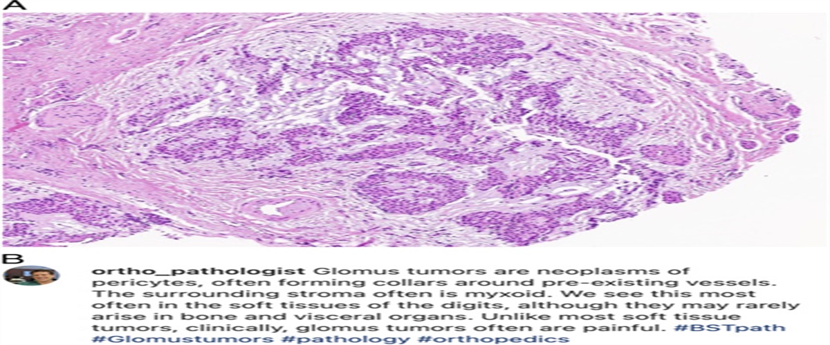 Highlighting Bone and Soft Tissue Pathology on Instagram