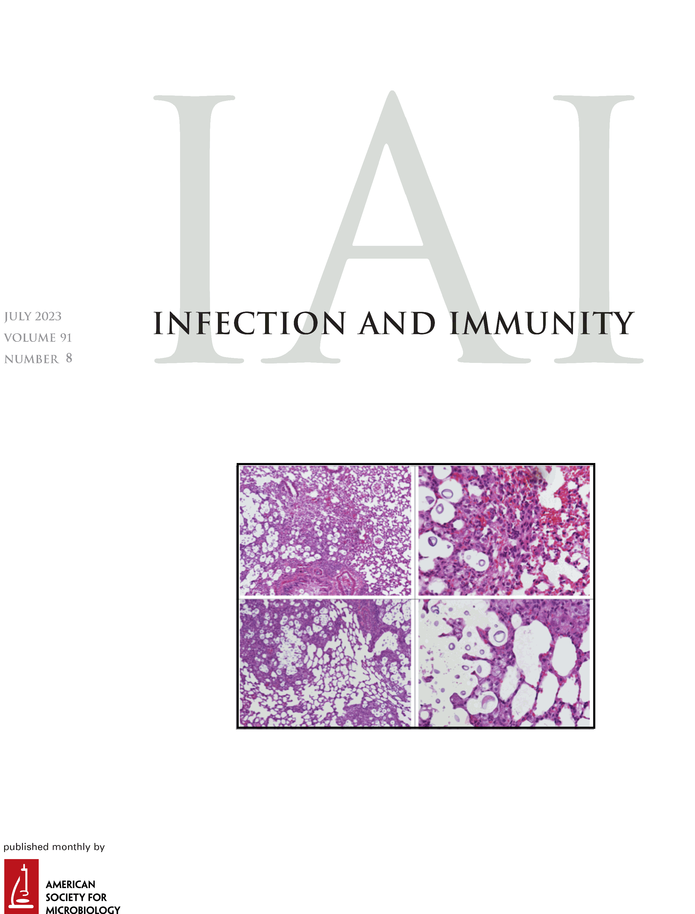 Susceptibility to Cryptococcus neoformans Infection with Bruton’s Tyrosine Kinase Inhibition