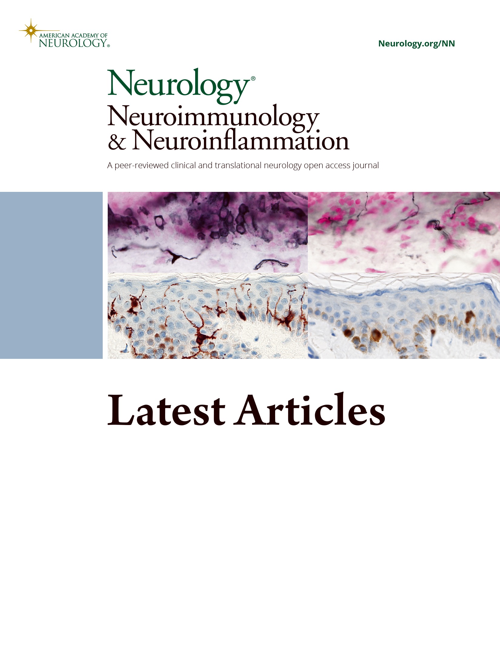 A 28-Year-Old Woman With Left-Sided Weakness and Atypical MRI Lesions: From the National Multiple Sclerosis Society Case Conference Proceedings