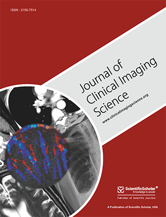 Complications with the use of Angio-Seal vascular closure device and their management